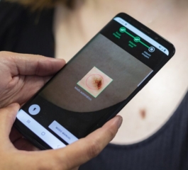 Aplicativos que detectam manchas de pele | Passo a Passo Para Baixar e Usar