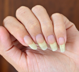 Misturinha Caseira para Ter Unhas Grandes e Fortes por Mais Tempo