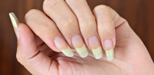 Misturinha Caseira para Ter Unhas Grandes e Fortes por Mais Tempo